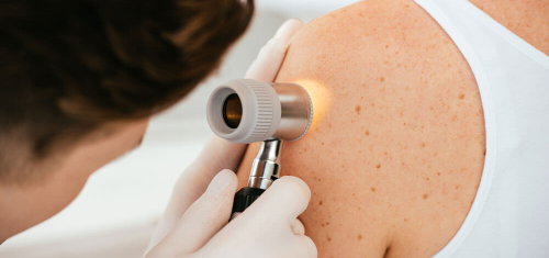 DERMATOLOGY
