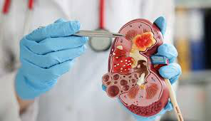 Nephrology Nephrology